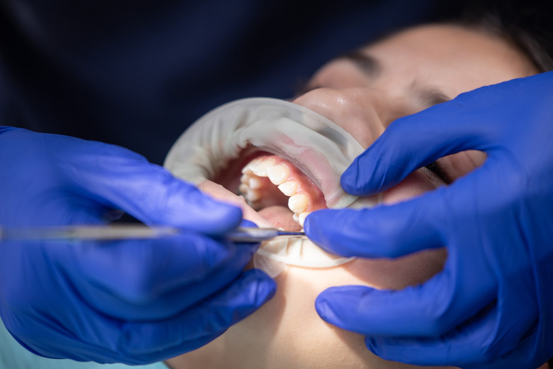 atamneri-verakangnum